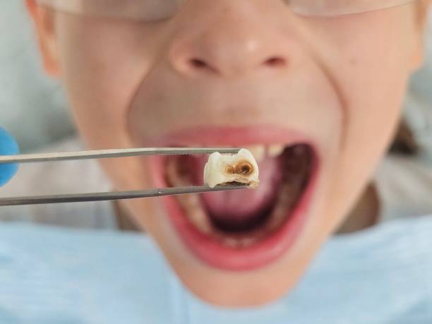 Best Emergency Gum Treatment in Callahan, FL